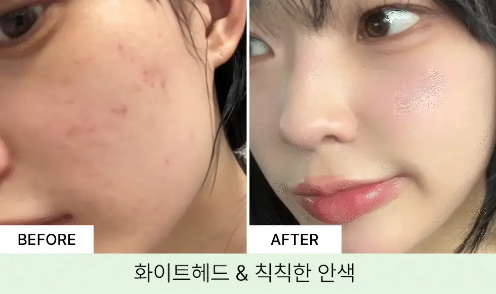 [머랭솝/팩브러쉬증정] 스킨시그널 클레이 효소클렌저 70g 팩브러쉬 증정기획 (핑크/그린) 상세페이지 59
